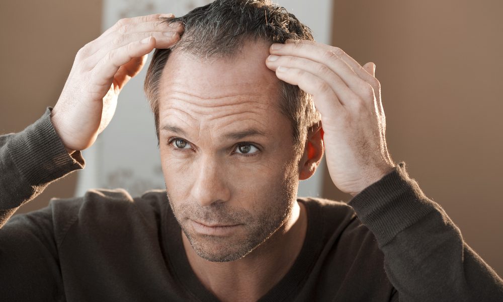 Does Anesthesia Cause Hair Loss? - RBR BUZZ